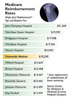 Medicare Reimbursement Rates - Major Joint Replacement